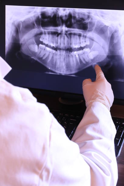Best Broken or Cracked Tooth Emergency Dentist in New Bremen, OH