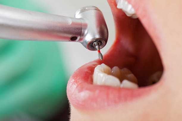 Best Pediatric Emergency Dentist in New Bremen, OH